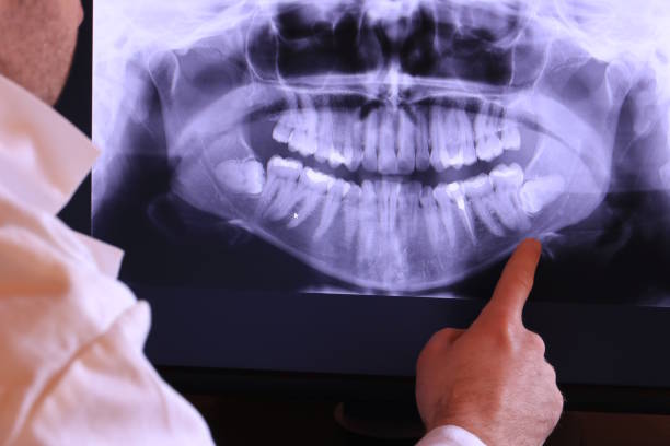 Best Emergency Denture Repair in Dickinson, TX